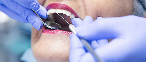 Best Emergency Wisdom Tooth Extraction in Vernal, UT